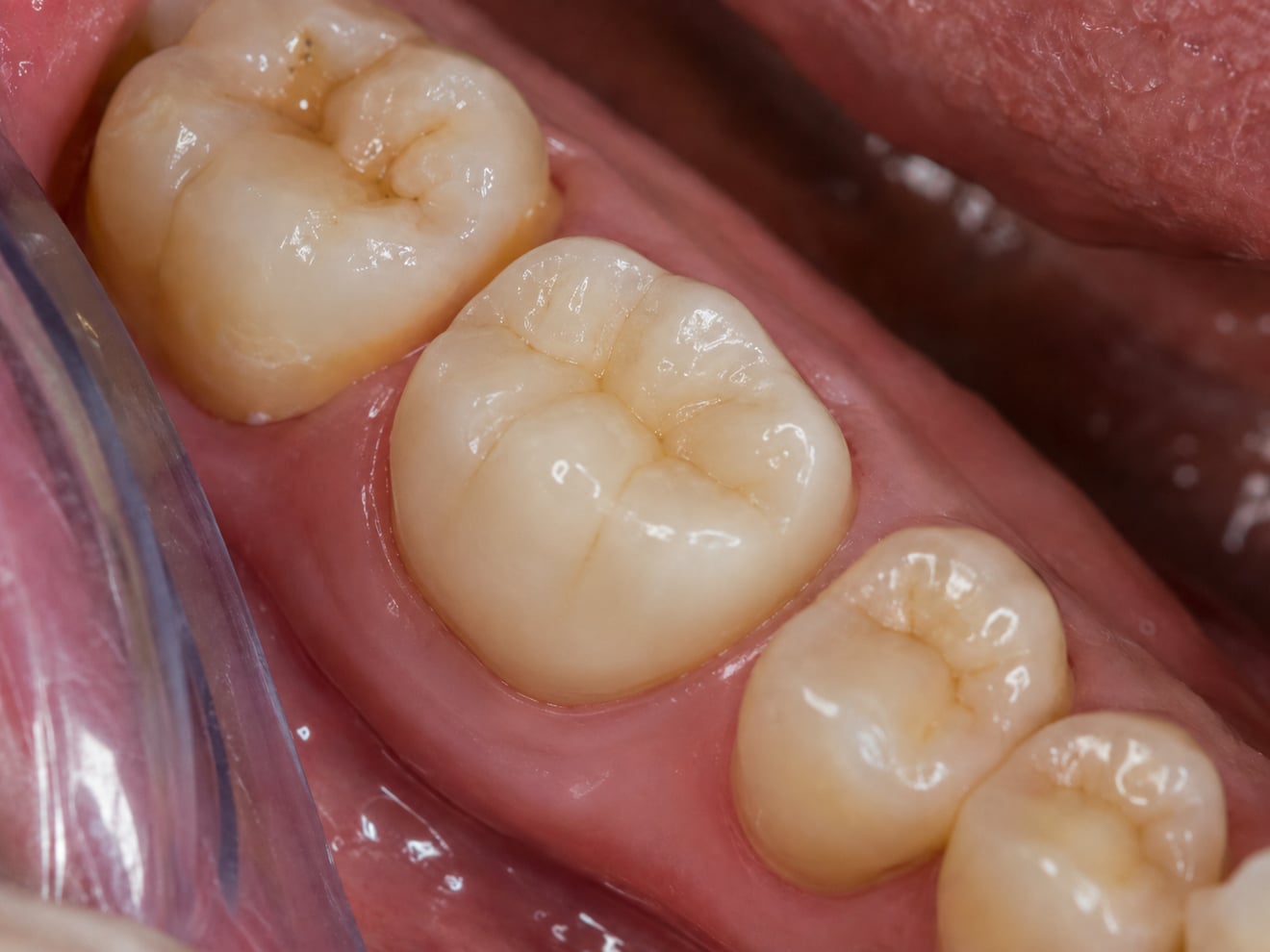 Пример работы — до и после